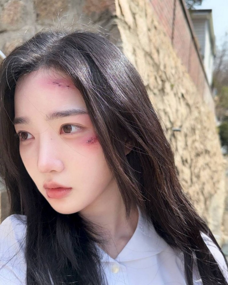 본문 이미지
