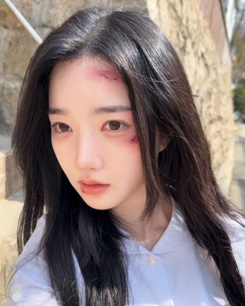 본문 이미지